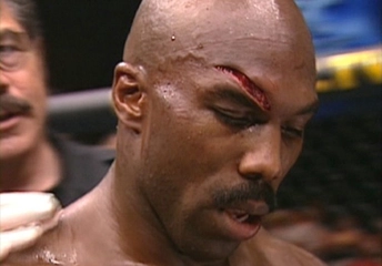 Kaş Yarılması Belirtileri ve Tedavisi