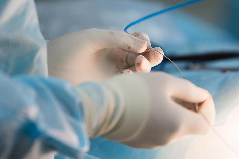 Dikişli Yara Belirtileri ve Tedavisi