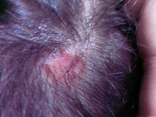 Kafada Çıkan Yaralar?