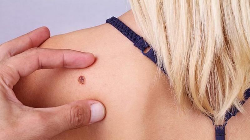 Vücutta Yara Belirtileri ve Tedavisi