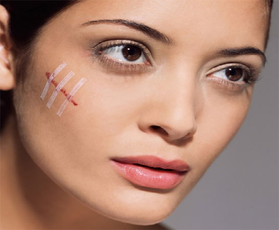 Yüzde Yara Belirtileri ve Tedavisi